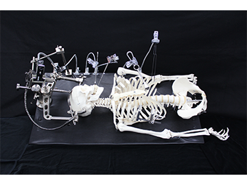 医療への取り組み | チタン医療製品の受託加工、OEMなら「株式会社東京チタニウム」